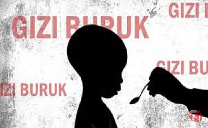 ilustrasi gizi buruk